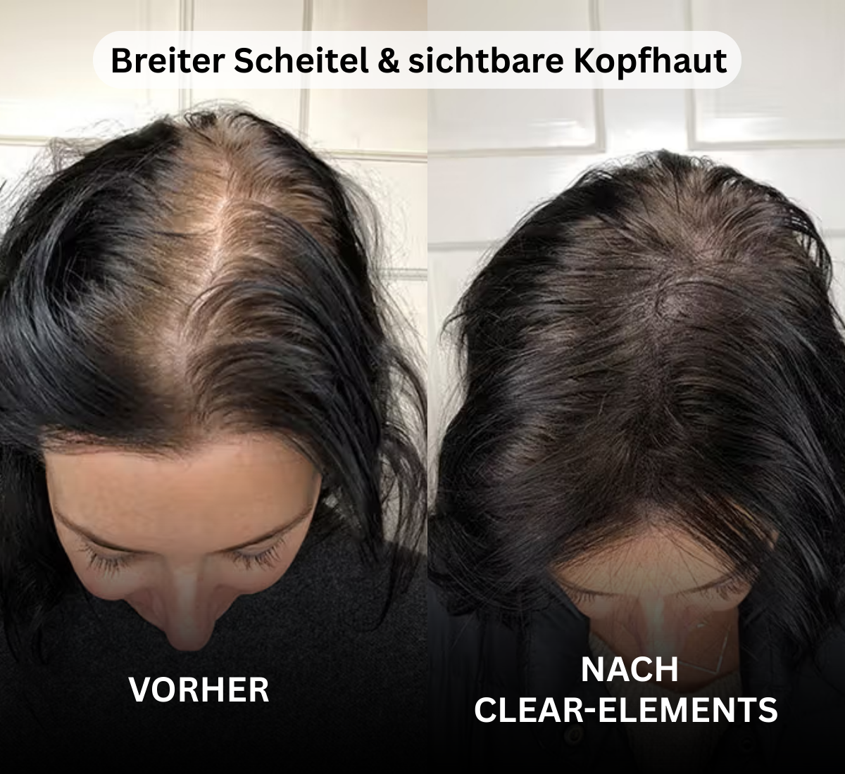 Hair Active Complex+ - Clear-Elements