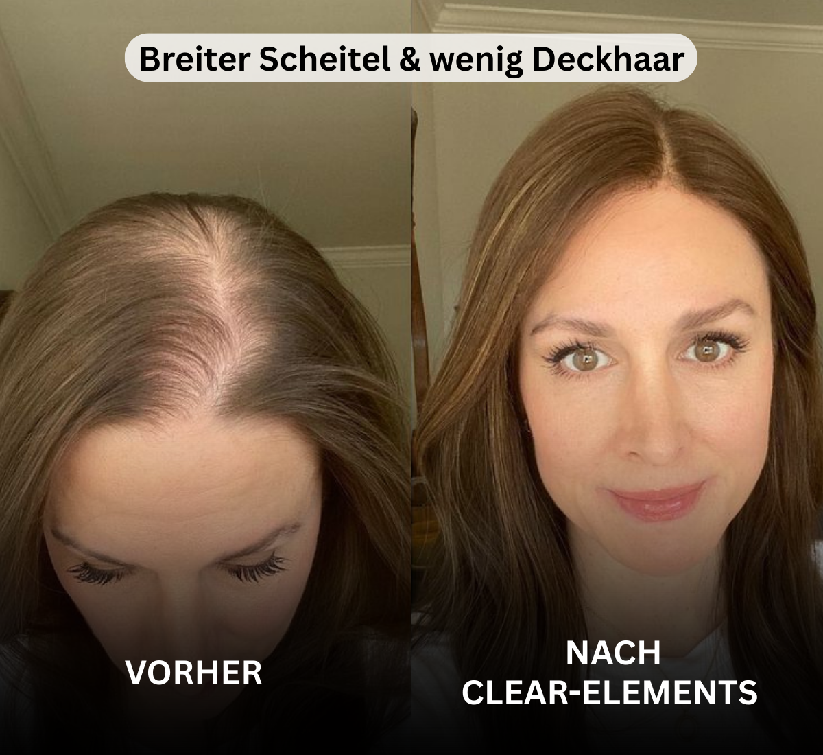 Hair Active Complex+ - Clear-Elements