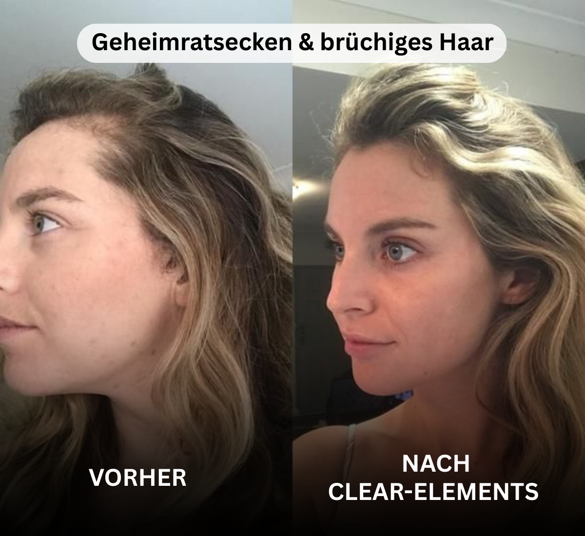 Hair Active Complex+ - Clear-Elements